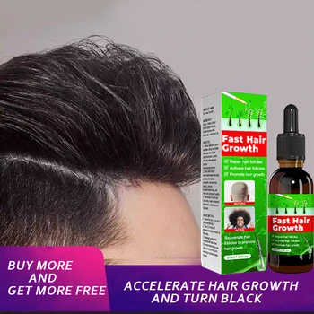 מהר צמיחת השיער מקדם מוצרים נשירת שיער תורשתית Alopecia Seborrheic טיפול שמן עבור צמיחת השיער, תמצית טבעית בטיחות - התמונה 1  