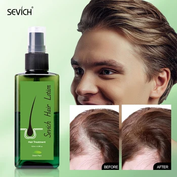 Sevich צמיחת השיער ספריי 120ml נגד נשירת שיער טיפול קרם טבעי צמיחת השיער ספריי סרום שיער הקרקפת טיפולים המוצר - התמונה 1  
